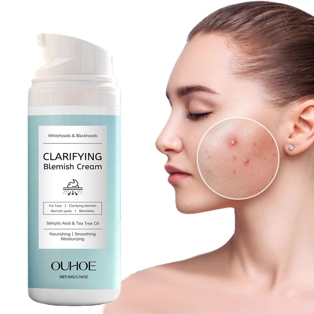 Azelaic Acid Cream - كريم الوجه بحمض الساليسيليك لعلاج حب