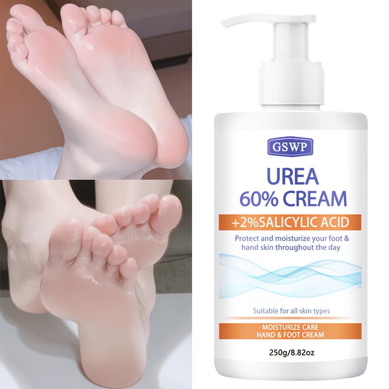 Azelaic Acid Cream - كريم GSWP المرطب لليدين والقدمين بنسبة