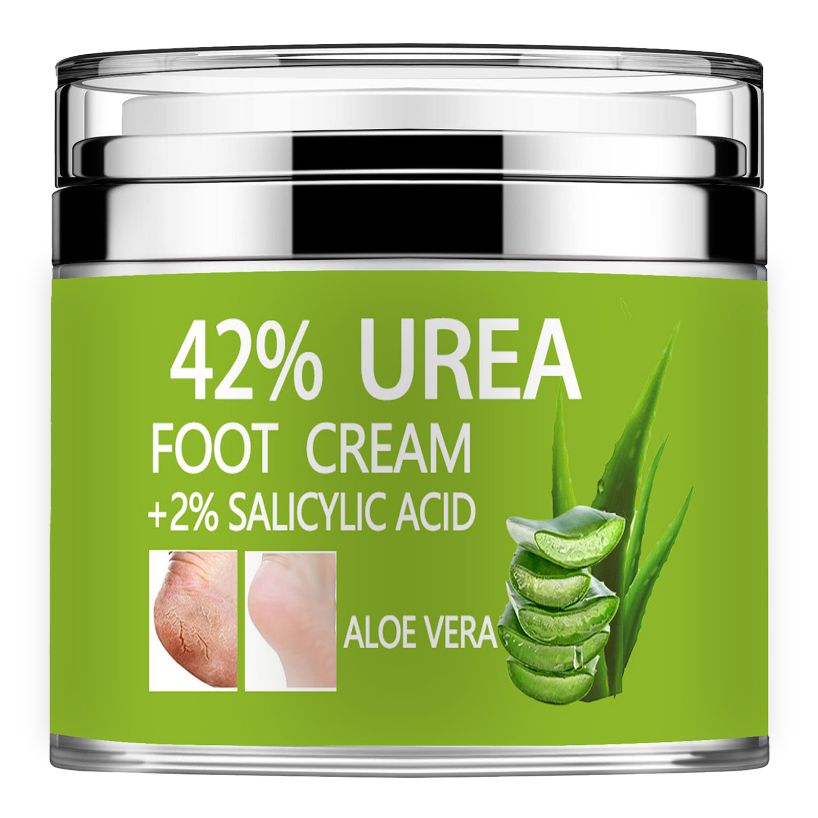 Azelaic Acid Cream - كريم اليوريا 42% بالإضافة إلى حمض