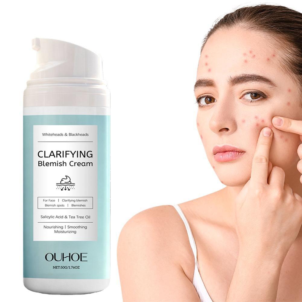 كريم الوجه بحمض الساليسيليك لع - مراجعة Azelaic Acid Cream وسعره