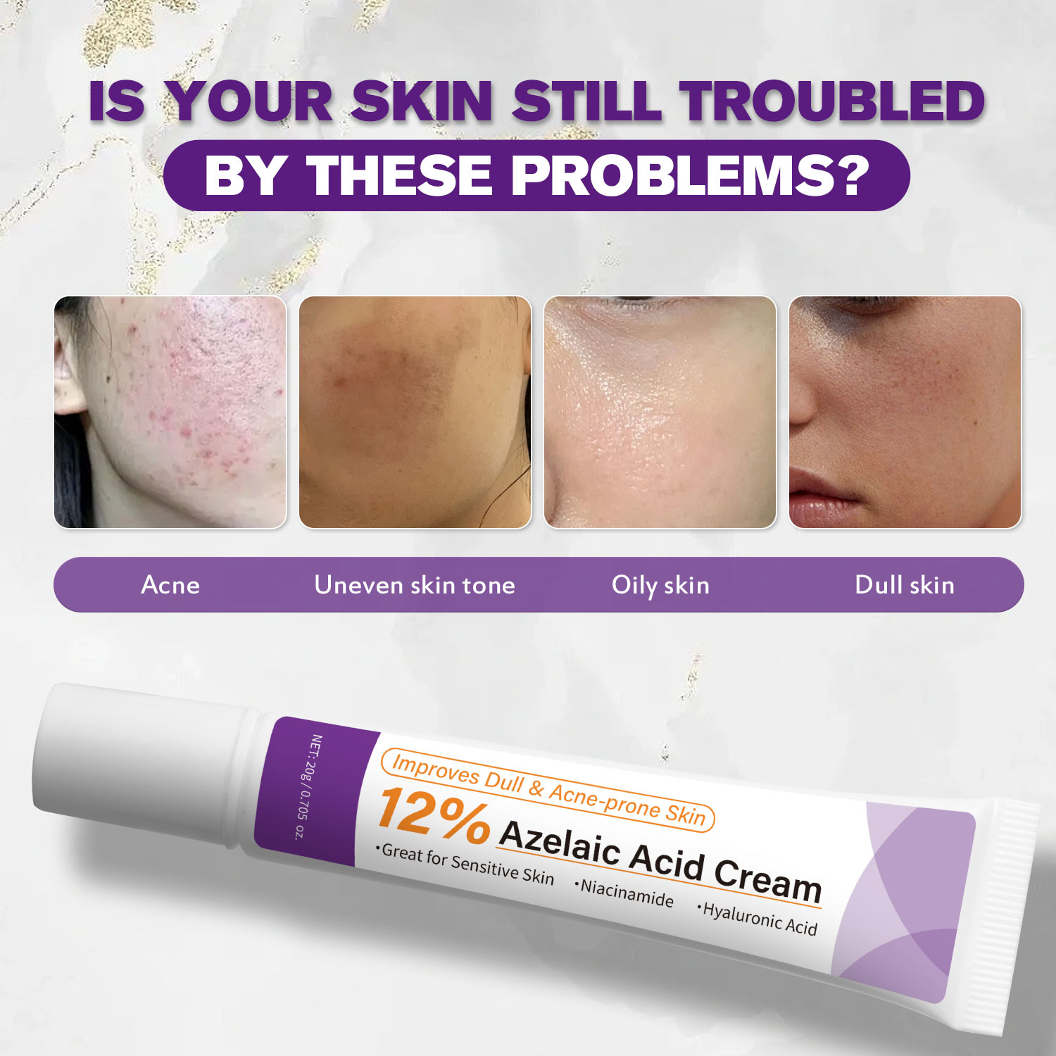 كريم حمض الأزيليك الخفيف لتحسي - مراجعة Azelaic Acid Cream وسعره