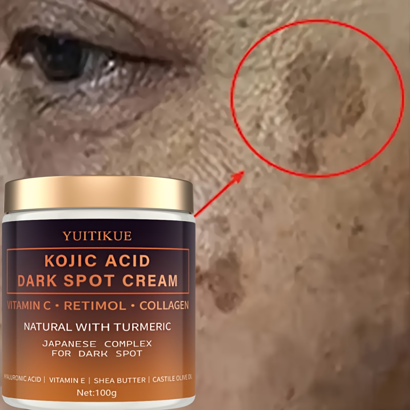 كريم أربوتين يتلاشى، فيتامين س - مراجعة Retinol Vitamin A Cream وسعره